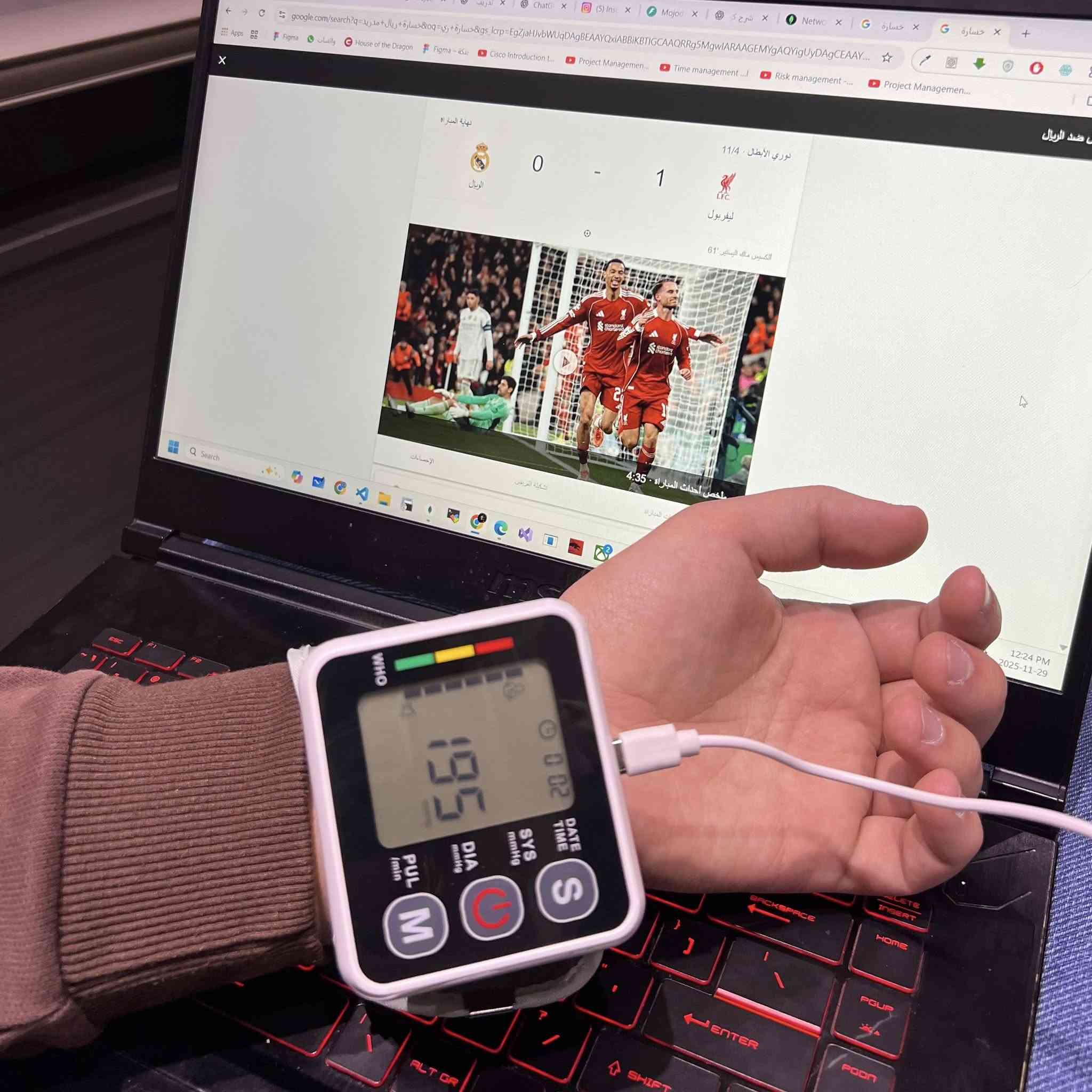 جهاز قياس ضغط الدم الإلكتروني للرسغ الناطق باللغة العربية منتج صغير الحجم ومحمول مصمم لتوفير قراءات سريعة ودقيقة لضغط الدم ومعدل النبض في أي وقت ومكان. إنه يتميز بتصميم سهل الاستخدام بزر واحد، مما يجعله مناسبًا لجميع الأعمار.
سهولة الاستخدام: يعمل الجهاز بضغطة زر واحدة (تشغيل/إيقاف) لتبدأ عملية القياس تلقائيًا بالكامل.يعمل بالكهرباء وبالبطاريات .

شاشة LCD كبيرة: يحتوي على شاشة رقمية واضحة ومضاءة خلفيًا لعرض النتائج بأرقام كبيرة، مما يسهل قراءتها حتى في ظروف الإضاءة المنخفضة.

قابلية النقل: بفضل حجمه الصغير ووزنه الخفيف، يمكن حمله بسهولة في حقيبة 

التخزين المرفقة، مما يجعله مثاليًا للاستخدام في المنزل أو أثناء السفر.

تخزين البيانات: يدعم الجهاز وظيفة الذاكرة لتخزين قراءات متعددة، مما يساعد في تتبع اتجاهات ضغط الدم بمرور الوقت.

كشف عدم انتظام ضربات القلب: يتضمن مؤشرًا ينبهك في حالة اكتشاف عدم انتظام في ضربات القلب أثناء القياس.

حافظ على الكفة في مستوى القلب 

ادعم ظهرك وذراعك 

حافظ على قدميك مسطحتين وساقيك مسترخيتين 

الشاشة: شاشة رقمية 

مصدر الطاقة: بطارية AAA DC3V.

نطاق قياس الضغط: 70-106 كيلو باسكال. 

الدقة: الضغط والنبض +/- 3% 

الأبعاد: الطول 78 × العرض 75 × الارتفاع 68 ملم 

نطاق قياس الضغط: الضغط: 0-299 ملم زئبقي، النبض: 40-180 نبضة/دقيقة

هذا الجهاز هو رفيق صحي ممتاز لمراقبة مؤشراتك الحيوية بسهولة ودقة.

السعر 15ألف


**إذا كنت صاحب هذا الإعلان وتريد حذفه لأي سبب، رجاءا أرسل رسالة إلى الدعم الفني**