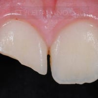 عيادات الكفيل • خدمات اسنان مجانية • النجف شارع الاسكان