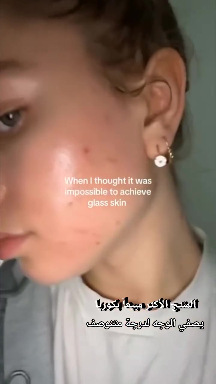 سيليماكس أمبولة سيروم نوني إنيرجي ✨🌿

استمتع بفوائد السيروم المميز لتعزيز إشراقة بشرتك!

✅ حيوية ونضارة: تمنح البشرة طاقة وحيوية، مما يجعلها تبدو أكثر إشراقًا.
✅ مكونات طبيعية: تحتوي على نوني، المعروف بفوائده الصحية والجمالية.
✅ ترطيب عميق: تعمل على ترطيب البشرة بعمق وتجعلها تبدو صحية ومرنة.
✅ تحسين المظهر العام: تساعد في تقليل مظهر البقع الداكنة وتحسين لون البشرة.
✅ سهولة الاستخدام: تصميم الأمبولة يجعل من السهل تطبيق الكمية المناسبة.

اجعل سيليماكس أمبولة سيروم نوني إنيرجي جزءًا من روتينك اليومي لتحصل على بشرة مشرقة ومليئة بالحيوية! 💖🌟
المنشأ كوريا الأصلي 🇰🇷 

#مواد_تجميل #سكن_كير #سيران_فريد #سيرافي_كريم_cerave #سيرافي_غسول #كوزمتك_هدى_يوسف #كوزمتك #كوزركس #لاروش_بوزيه #لاروش_ايفاكلار #سكنكير✨💆🏻‍♀️ #عالم_التجميل


**إذا كنت صاحب هذا الإعلان وتريد حذفه لأي سبب، رجاءا أرسل رسالة إلى الدعم الفني**