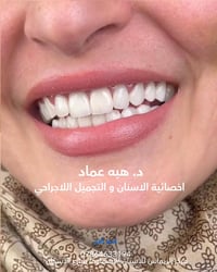 ابتسامة هوليود • دكتورة هبه عماد • مركز الريماس السماوة