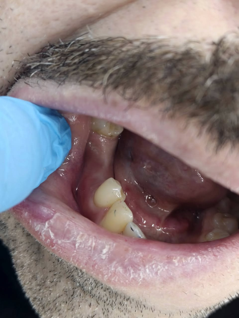 يتوفر علاج اسنان مجاني (حشوات ضوئية، تعويض اسنان مفقودة، قلع بقايا الجذور والاسنان التالفة، وتنظيف الاسنان، وحشوات الجذور)
العلاج يكون  مجاني بالكامل وتحت إشراف اطباء اخصائيين، جامعة البيان شارع مطار بغداد، 
للحجز و الاستفسار التواصل في الخاص او على الواتساب ***********
