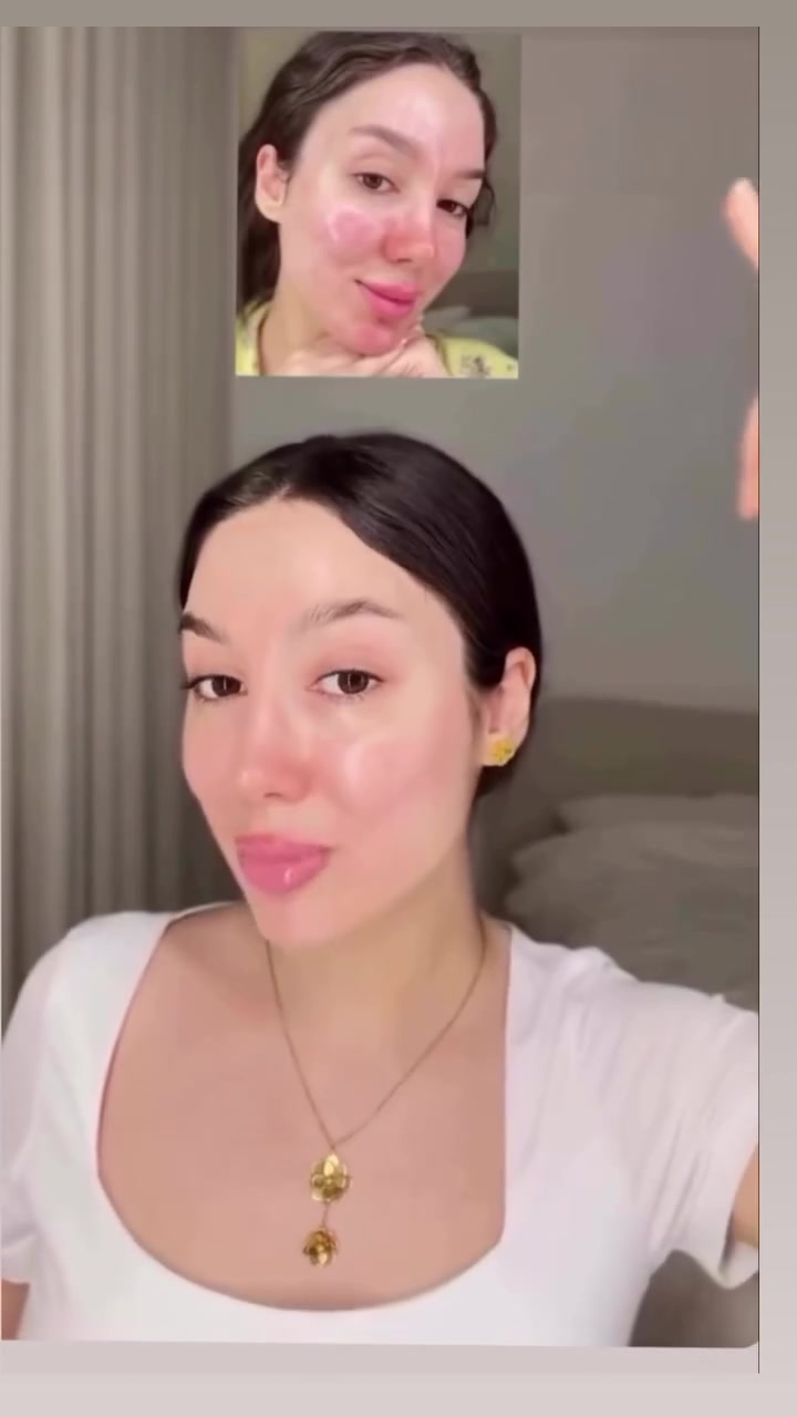 إذا تعبتي من البشرة الباهتة والتصبغات… فهذا السيروم راح يفرق من أول أسبوع ✨🍒
Glow كوري + ترطيب عميق + توحيد لون ببشرة زجاجية تخلي الكل يسألج شنو سر نضارتچ 😍
🔥 هسه عليه خصم مغري
🚚 والتوصيل مجاني لكل المحافظات
الكمية محدودة… لا تطوفچ الفرصة 💛


**إذا كنت صاحب هذا الإعلان وتريد حذفه لأي سبب، رجاءا أرسل رسالة إلى الدعم الفني**
