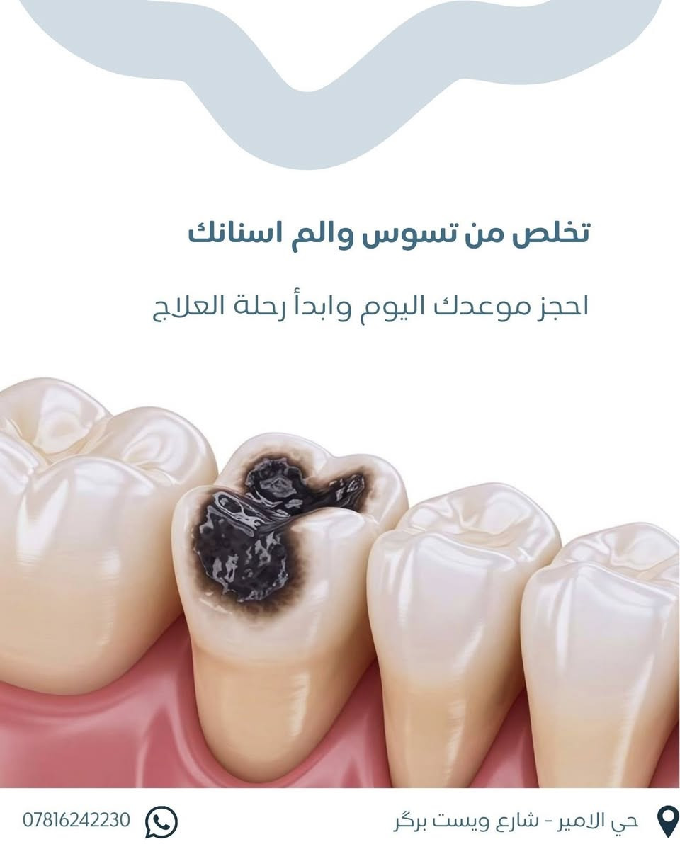 نقدم لكم في عيادتنا مجموعة متكاملة من خدمات طب الأسنان:

✔️ معالجة تسوس الأسنان
✔️ قلع الأسنان المتضررة
✔️ تنظيف الأسنان وإزالة التكلسات
✔️ تبييض الأسنان
✔️ ابتسامة هوليوود
✔️ التركيبات الثابتة
✔️ زراعة الأسنان

💳 أسعار مناسبة وإمكانية الدفع على الجلسات

📍 الموقع: حي الأمير – شارع ويست برگر
📞 للحجز والاستفسار: ***********

✨ صحتك وابتسامتك تستحقان أفضل عناية… احجز موعدك الآن ودعنا نهتم بابتسامتك. 🦷💙
