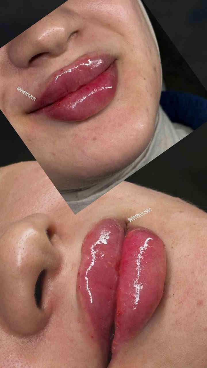 العنوان....الفرع الاول /الاعضميه سبع ابكار قرب منتزه الهبي دي مجاور اسواق الروان
الفرع الثاني/الدولعي شارع بيوت فنجان مقابيل مؤسسه فنجان الحكوميه للأستفسار والحجر الاتصال ع هذا الرقم 👈🏻***********
