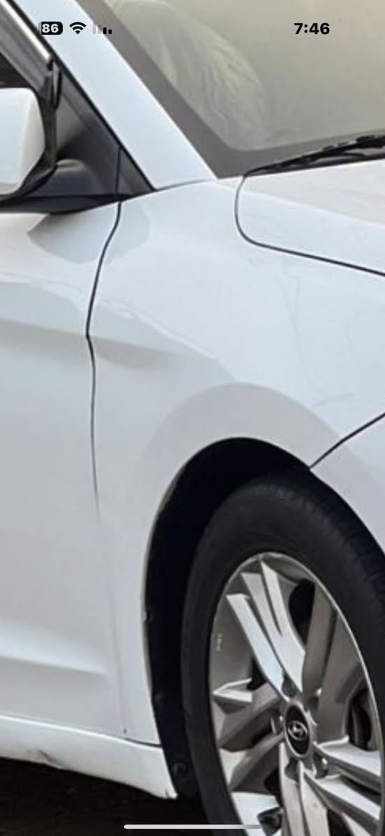 سلام عليكم بيع او مراوس سياره معروفه مواصفاتها امريكي بيها طخه بل جملغ اليمن معمر نفسه اليبل واحد بدون دواخل 140 بيها مجال الطيبين.  ***********
