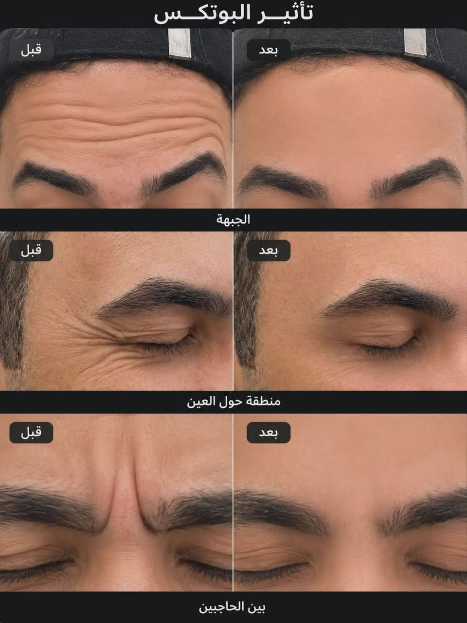 تجميل الاجراحي مع الدكتورات من عياده دكتور محمد فتين الدريعي  
د. عفراء محسن ناصر شنيع🦷👑
د. فاطمة محمد عارية 🦷👑
رقم الحجز&0772043200🍓


**إذا كنت صاحب هذا الإعلان وتريد حذفه لأي سبب، رجاءا أرسل رسالة إلى الدعم الفني**