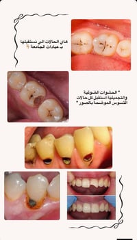 العلاج مجاني بالكامل تحت أشراف كادر طبي متخصص// للحجز والأستفسار مراسل...