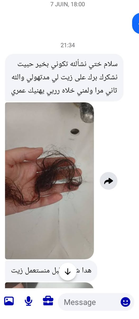 ربي يبارك من الاستعمال الاول شوفو التساقط تاع شعرها كيفاه خف ودرتلو تخفيض نعاون فيكم مع انو والله ثلاااث ماراح تلقاوه بالسعر هادا ويمدلكم نتيجة كما تاعي . مالا يا خويا زيت اختي لي يعاني من اي مشكل فالشعر ماتضيعش وقتك ودراهمك فالحاجة لي ماتستاهلش . مرحبا بيكم اغتنمو الفرصة سمانة نحبس التخفيض.


**إذا كنت صاحب هذا الإعلان وتريد حذفه لأي سبب، رجاءا أرسل رسالة إلى الدعم الفني**