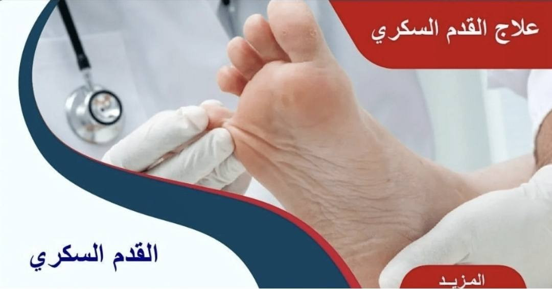 موقع العيادة عمارة اسواق سليمانية بداية نزال سليم 
موجودين قبل الفطور و بعد الفطور لحد ساعة ١٢ بليل
وكذلك على الواتساب للاجابة عن اي استفسار 
و متوفر خدمة طبية منزلية
***********
