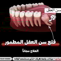 قلع سن العقل • مجانا • جامعة كربلاء