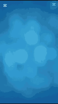 🩺 الدكتور  ارشد الحاتمي – اختصاص
امراض المفاصل والفقرات والروماتيز/
انزلاق الفقرات - سوفان المفاصل
هشاشة العظام- داء النقرص
تأهيل الاصابات الرياضة
——————————————
التهاب المفاصل الصدفي هو نوع من التهاب المفاصل يؤثر على بعض مرضى الصدفية — وهو مرض تظهر خلاله بقع حمراء على الجلد تعلوها قشور فضية. يُصاب معظم الناس بالصدفية قبل تشخيص إصابتهم بالتهاب المفاصل الصدفي بعدة سنوات. ولكن بالنسبة للبعض تبدأ مشاكل المفاصل قبل ظهور البقع الجلدية أو في نفس الوقت

يسرنا إعلامكم بأن الدكتور (ارشد الحاتمي )يستقبل مراجعيه من الساعة 4 مساءً الى الساعة 8 مساءً

📞 للحجز والاستفسار:

***********

العنوان :التحرير_الفلكة الاولى_مقابيل مول ماريا
