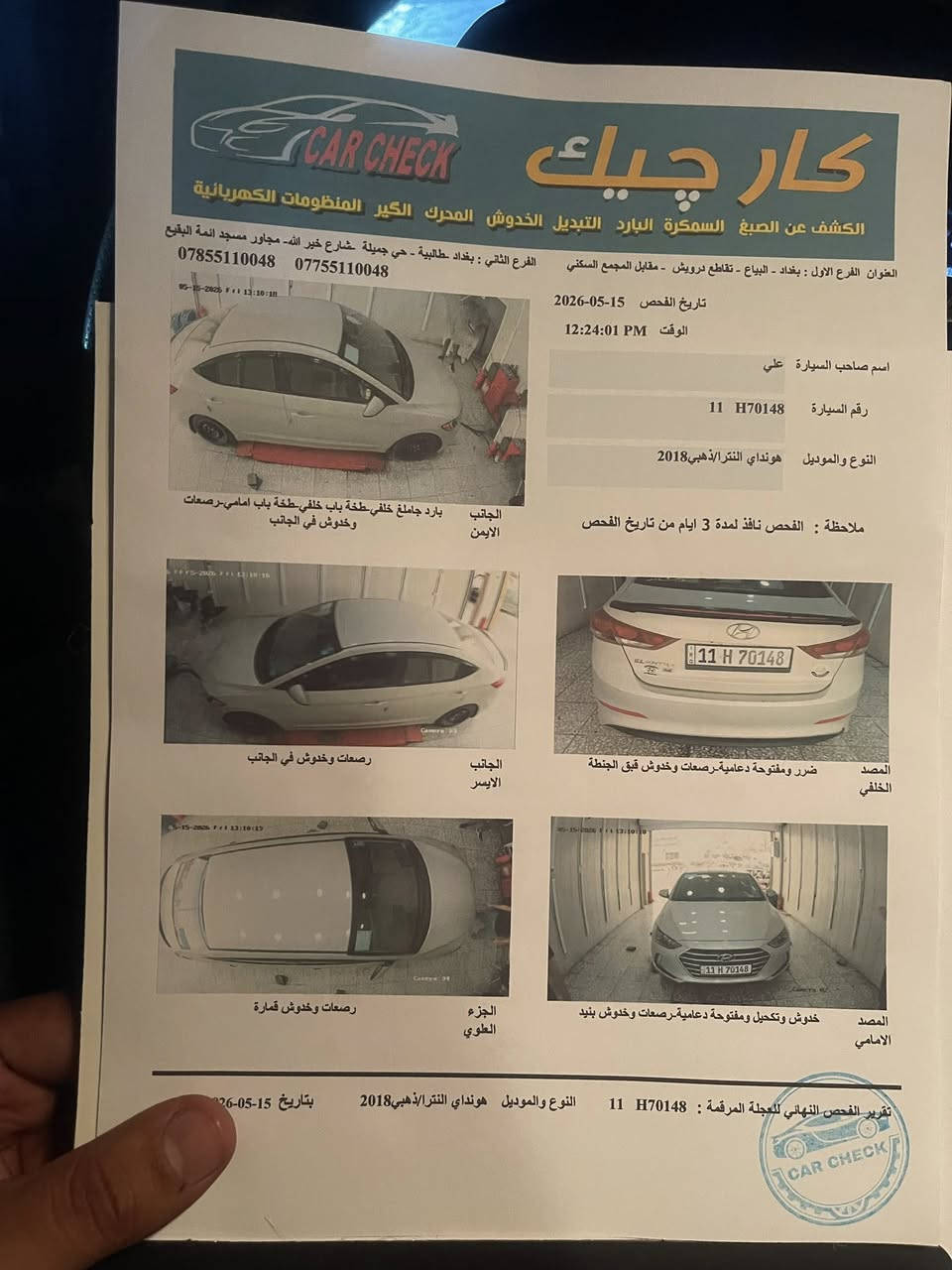 سلام عليكم النتره مديل18 مكينه الفين دوش
سياره اليبل واحد حادثهه دعاميه اماميه وبيهه بارد باجملغ لخلفي
سياره حلوه وجاهزه اللخير 
مكان سياره مدينه الصدر 
الرقم ***********
السعر 130وبيهه مجال
