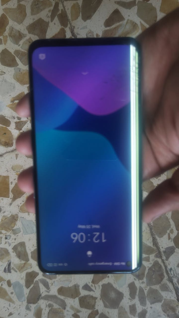 السلام عليكم جهاز. ريلمي q 3 pro سبيشل  يحتاج تبديل شاشة لمس من الوسط ما يلمس اذا تستخدمه على وضع بس تكتوك ويتيوب يفيدك يحتاج شاشة سعره 80 وبي مجال


**إذا كنت صاحب هذا الإعلان وتريد حذفه لأي سبب، رجاءا أرسل رسالة إلى الدعم الفني**