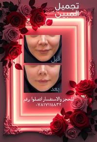 تغيير نازك يرجع شبابك و نعومتك  روتوش فيلر باسلوب حديث نحو تجددك للحجز...