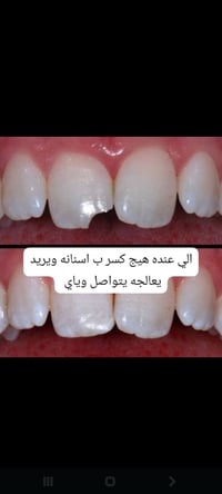 للعلم العلاج مجاني التواصل ع الرقم 07848959801 واتساب