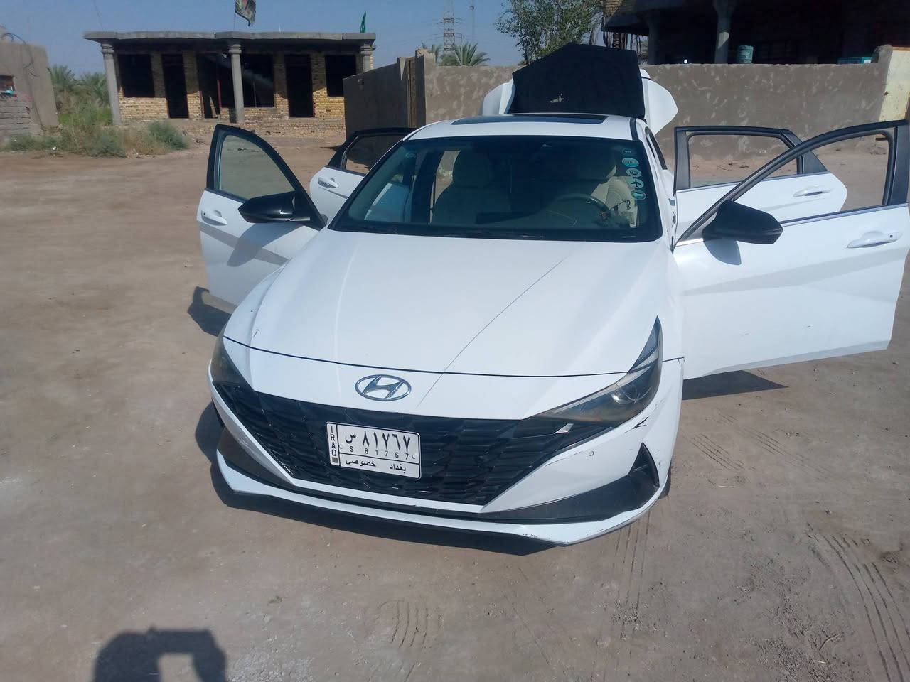 النترا خليجي موديل 23 مكينه الفين مجفته شركه ضمان بيها الشراي يتصل خط بي واتساب مالك ابصخير سياره بشاميه مطفوله باب سايق بي شبر لو اكثر شويه وجاملغ الكدام بي شبر صبغ وجنطه طخه موضحه بدون تصليح الشراي يتصل وبي خير ويدلل ***********
