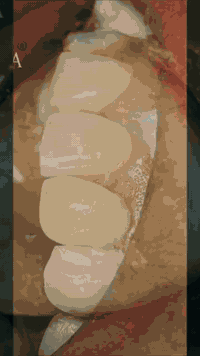 ابتسامة هوليوود & المشاهير 🎇
زراعة الأسنان & تقويم الأسنان 🥼
حشوات (ضوئية & جذور) 💁🏼‍♂️
( ابتسامتك جميلة ومضيئة )🥼🦷
العنوان _بسماية_الشارع العام 📍
للحجز والأستفسار مراسلة الصفحة أو التواصل عن طريق الواتساب ***********
