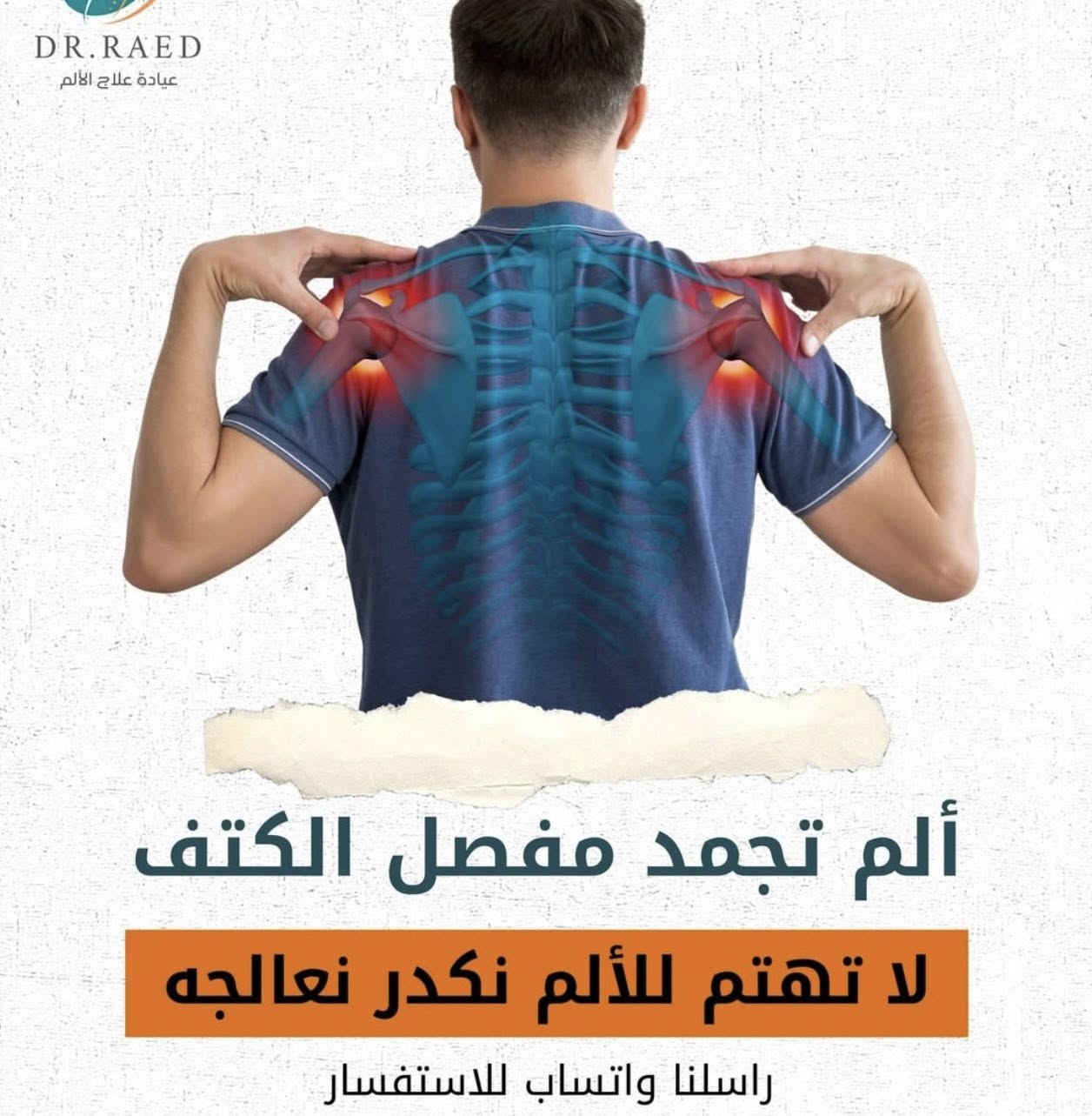 � العنوان:
بعقوبة الجديدة – خلف جامع سارية
داخل مجمع هيثم حميد الشمري

كشفيه مجانية 🛑 عرض لمدة اسبوع✅
سعر الجلسة 20 الف ✅

🦴 عيادة علاج طبيعي وتأهيل إصابات💙
نقدّم برامج علاجية متكاملة لحالات الألم والإصابات، وتشمل:

▪️ آلام الفقرات العنقية (الرقبة) والقطنية (أسفل الظهر)
▪️ الانزلاق الغضروفي وآلام الدسك
▪️ خشونة المفاصل (السوفان) وآلام المفاصل المزمنة
▪️ آلام الركبة وتأهيل ما بعد الإصابات
▪️ إصابات الملاعب والتمزق العضلي وتمدد الأربطة
▪️ مشاكل الأعصاب مثل العصب السابع والعصب الخامس
▪️ حالات الشد العضلي والتنميل والخدران

نركّز على تشخيص دقيق،
علاج طبيعي بدون جراحة،
وبرامج تأهيل تهدف لتخفيف الألم، تحسين الحركة،
وإرجاع المريض لنشاطه اليومي بأمان وثقة 💪🌿

📞 للحجز والاستفسار: ***********
