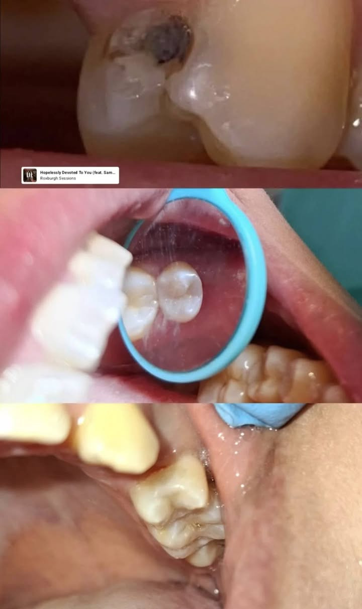 السلام عليكم
عيادة رينيو لطب وتجميل الاسنان
 بإشراف دكتورة كربلاء الاسدي بكلوريوس طب جامعه بغداد سرتفكيت فى التجميل اللاجراحي
للحجز: ***********
العنوان: بغداد مدينه الصدر قطاع 14 مقابل صورة السيـد .
