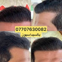 ملاحظة مهمّة جدًا 👇 قبل لا ينسرق الكلام من قبل المراكز ويبدون يحچون بن...