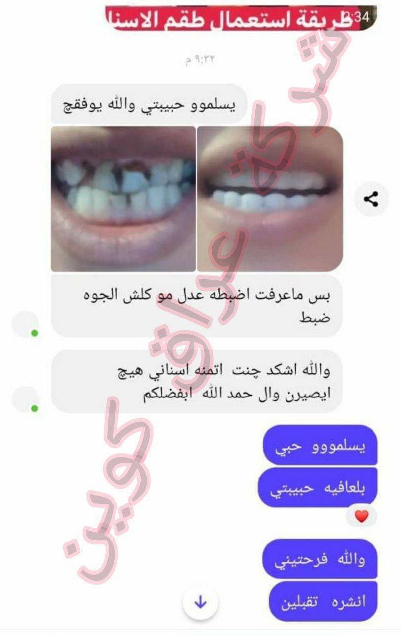 طقم اسنان  snapon smile
snapon smile شلون تتركب كم مده
تبقى.......الخ

شوفو حبايبي 💋بالبدايه تنضفون اسنانكم واول شي تخلون السيلكون بماء حار
((تجي وي كل فك سلكونه عباره عن ماده جيلاتينيه صلبه)) ‼️
وتخلو ع الاسنان بعده تلبسون الفك راح يتخذ الحجم المناسب للاسنان استخدامه كوولشي سهل طبعا يستخدم للمناسبات او الايام العاديه كولش مناسب وسهل وينطي مضهر حلو

🦷عادي تفرشو بمعجون وفرشه 😅
🦷عادي تاكلون بي وابد ميتلون  سواء شربتو شاي او قهوه ....
🦷عادي تنامون بي ...
🦷عادي تلبسو 24 ساعه ..
🦷عادي تشيلو وترجعون تلبسو مره ثانيه.
🦷كوولش طبيعي ....
🦷مناسب لكافه الاعمار ...
🦷مصنوع من ماده السيليكون القوووي
يبقى طول العمر طبعا بعد متشيلي تحفظي بالعلبه الخاصه بي

🚘يوجد خدمة توصيل لجميع محافظات العراق ٤ الاف🚘


**إذا كنت صاحب هذا الإعلان وتريد حذفه لأي سبب، رجاءا أرسل رسالة إلى الدعم الفني**