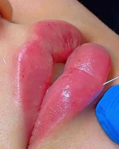 اليوم جبتلكم عروض راس السنة 🤗🤗
عروض بلاش 
تسريح شعر على كل100 مليم 25 الف فقط 
حفافة+تنظيف بشرة بجهاز الهايدرو فشل تنظيف عميق 10 الف فقط 
صبغ الشعر القصير 15 الف المتوسط 25 الطويل 30
تاتو الحواجب ب25 فقط 
توريد شفة 25 فقط 
اكرلك اضافر 25/20/15
العنوان شارع الاربعتلاف مجمع الجوادين 
 الطابق الثالث 
للاستفسار اكثر الاتصال على الرقم ‏‪‏‪***********‬‏
@إشارة
