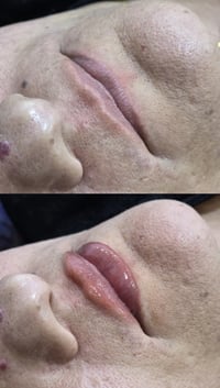 فلر شفه • مواد اصلية • توله فروش