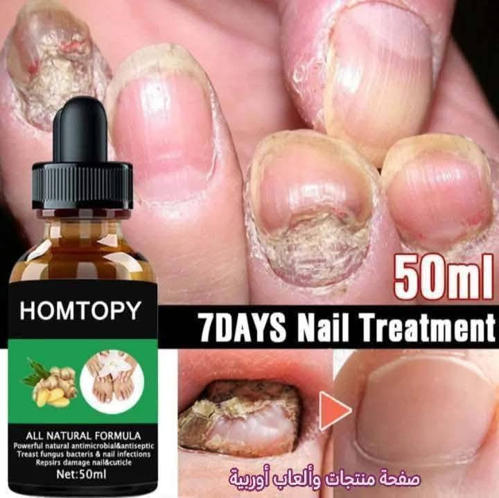 أتوفر سيروم HOMTOPY الاصلي سيروم ال 7 أيام صار تكدرون تتخلصون من الفطريات والبكتيريا وعدم اطالة الاضافر بشكل صحي وبدون مشاكل  وبمكونات طبيعية100% خلال اسبوع فقط المنتج اصلي لا نتعامل بالمنتجات المقلدة

✅علاج فطريات الأظافر "

✅علاج الأظافر والبكتيريا والالتهابات 

✅علاج الأظافر التالفة والبشرة المحيطة بالأظافر.

✅تطويل الاضافر بشكل نظيف  

المكونات: طبيعية بالكامل، وتعمل كمضاد للميكروبات ومطهر.
الوزن الصافي: 50 جرام.

للحجز والاستفسار راسلوا الصفحة لطفا
تتوفر خدمة توصيل لجميع المناطق والمحافظات


**إذا كنت صاحب هذا الإعلان وتريد حذفه لأي سبب، رجاءا أرسل رسالة إلى الدعم الفني**