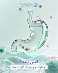 وزنك زايد؟ عمليات قص المعدة وتغيير المسار قد تكون الحل الطبي الفعّال ل...