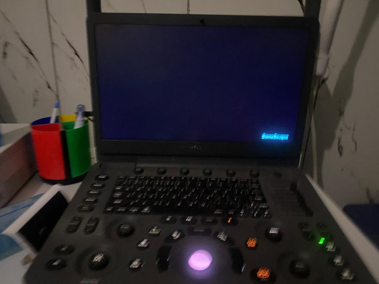 جهاز سونار نوع سونو سكيب نوع E1  بروبين باطني وداخلي نسائي موديل 2020 نظافه 98‎%‎ استخدام قليل للبيع مع طابعة الصور السونار نوع سوني وجهاز شحن اصلي للاستفسار واتساب ***********
