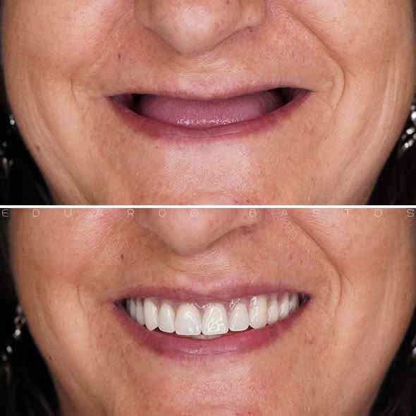 ✅مجانا مجانا مجانا✅
🦷 هل تبحث عن:

• تنظيف الأسنان (ازالة التصبغات والتكلسات)

• قلع أسنان او بقايا جذور

• حشوة ضوئية ( بيضاء)

• تعويض أسنان مفقودة (طقم اسنان)

الآن هذه الخدمات متوفرة في كلية طب الأسنان – جامعة الاسراء 

بإشراف دكاترة مختصين.

✅ جودة وأمان عالي

✅ علاج مجاني بالكامل

✅ مكان موثوق

كرادة ساحة الاندلس/عيادات جامعة الاسراء  

📞 للحجز والاستفسار مراسلتي على الخاص 

او على هذا رقم ***********
