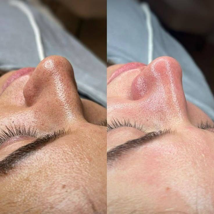 غسول الوجه "YC Whitening Face Wash" هو منتج لتنظيف وتفتيح البشرة، يحتوي على خلاصة النيلة الزرقاء المغربية. 
يعمل الغسول على تنظيف البشرة بعمق وتوحيد لونها.
يساعد على إزالة البقع الداكنة والتصبغات.
له خصائص مهدئة ومرطبة للبشرة.
المنتج مصنوع في تايلاند.


**إذا كنت صاحب هذا الإعلان وتريد حذفه لأي سبب، رجاءا أرسل رسالة إلى الدعم الفني**