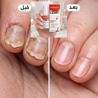 مقوي اظافر • مافالا • صنع سويسري