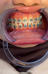 يتواجد الدكتور اليوم إن شاء الله من الساعة 1 بعد الظهر الى الساعة 5 حش...