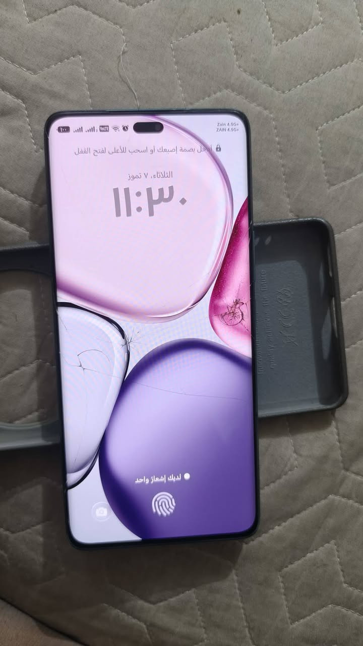 جهاز هونر اكس 9سي شاشه مفطره بس مابي شي لا تعليك ولا شي وياه كرتونه وشاحنه وسماعاته سعر 270☺️


**إذا كنت صاحب هذا الإعلان وتريد حذفه لأي سبب، رجاءا أرسل رسالة إلى الدعم الفني**