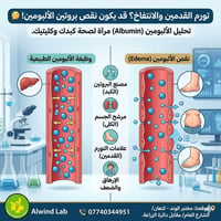 تحاليل الألبومين • تورم القدمين • مختبر الوند