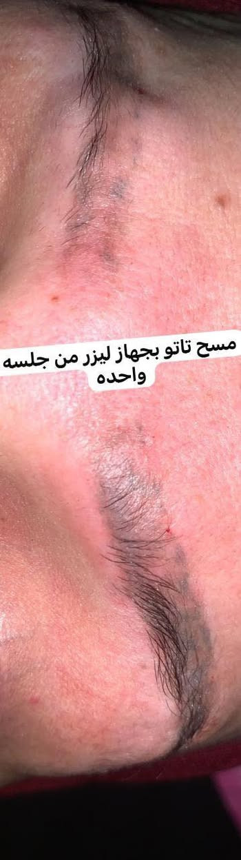 اصيل بيوتي للتجميل وليزر
رؤى الجبوري 

شارع الصالونات مجاور شركة اسيا سيل

نفس عماره باور جم طابق ثاني❤️

***********

لحگوا عرووض ونتائج👌💉
