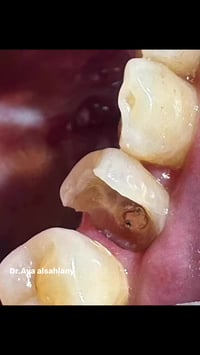 عيادة آية السهلاني • طبيب أسنان • الشرطة الخامسة