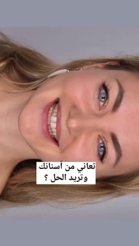 بكج تبييض اسنان • مبيض فوري • رغوة فموية