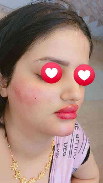 عروض ولاول مرة اسعار ولا في الخيال تحطيم الاسعار🤛
نبدي بعروض الاكرلك 💅
فول دزاين ب20الف فقط 😍
دزاين ب15
سترونك ب10
تبسات ب10
جلش فثط ب5
تنظيف قدم ب5فقط
قص شعر ب5فقط
حفافة وشمع ب5فقط
ميش شعر قصير 15
ميش من الكتف للخصر ب25
 فلر سعر السيسي الواحد👄 فلر اودري ب25
فلر كوري اراستي ب50
فلر كوري آبتك ب75
التغير الشامل بالفلر الكوري 250
بوتكس عين القط ب100
بوتكس جبين كامل ب100
بوتكس وجه كامل ب250
بلازما انبات وتقوية بصيلات  الشعر ب75
بلازما مفعلة ب35
جميع انواع التاتو ب25
الوشومات تبدي من ال10وفوك
بغداد /دورة/ابو دشير /الشارع العام بالقرب من مكتبة حيدر الضامد سنتر ريفان بيوتي
***********
#هاشتاك @إشارة #بغدادبصرةاربيل #كربلاءديوانية
