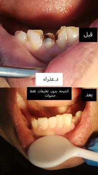 دكتورة عذراء طالب • قضاء سومر • الديوانية