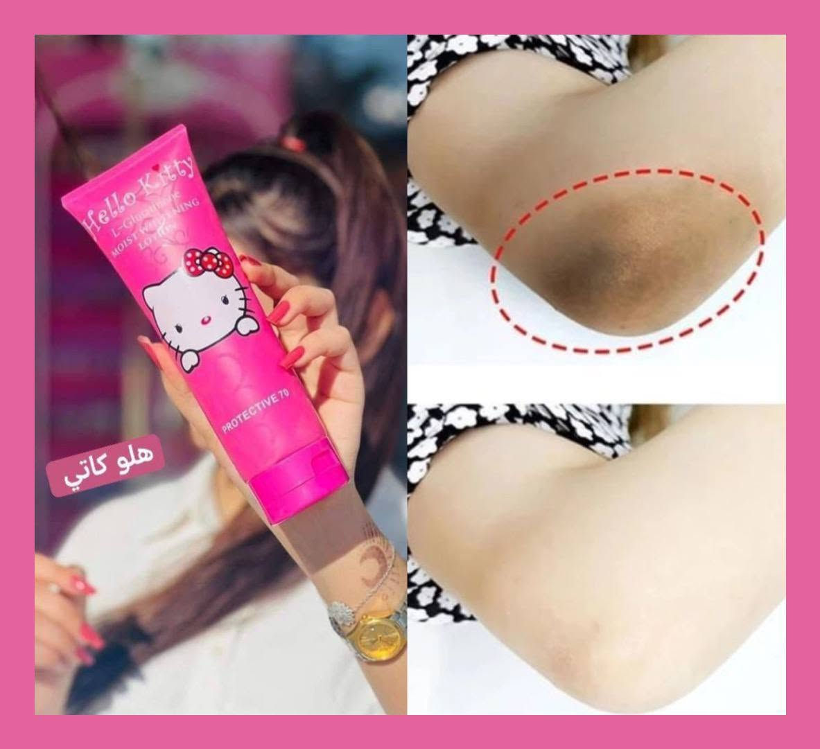 🌸 لوشن هلو كيتي الياباني الأصلي 🇯🇵✨
لكل بنية تدور على بياض طبيعي ونعومة فائقة، وفرنالكم المنتج السحري الأكثر طلباً!
ليش راح تحبّيه؟ 🤔💖
 تبييض وترطيب فوري: يبيّض البشرة بلحظات وينطيها نضارة وإشراقة طبيعية تدوم لأكثر من يوم، وبدون ما يترك أي أثر أو بقع.
 حماية عالية من الشمس: يحتوي على نسبة حماية SPF 70 ليحمي بشرتِج طول اليوم 🌞.
 مكونات مغذية: غني بالجلوتاثيون اللي يفتح البشرة تدريجياً ويعالج التصبغات.
 عناية متكاملة: يرطب بشكل عميق جداً، ومناسب لكل أنواع البشرة.

السعر خاص


**إذا كنت صاحب هذا الإعلان وتريد حذفه لأي سبب، رجاءا أرسل رسالة إلى الدعم الفني**