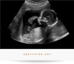 الدكتورة
                 #خنساء_حميد_الدليمي
طبيبة اختصاص بورد(دكتوراة ) جراحة الأمراض النسائية والتوليد
#ماجستير_في_معالجة_العقم
معالجة مشاكل العقم المعقده والممتده لسنوات عديدة
#الفحص_بجهاز_السونار_الحديث_والدوبلر
#مجمع الرازي الطبي ابوغريب الحصوه
مجاور صيدلية غفران عامر سامي
للحجز والاستفسار ***********_***********
