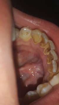 تنظيف أسنان • مجاناً • كربلاء السعديه