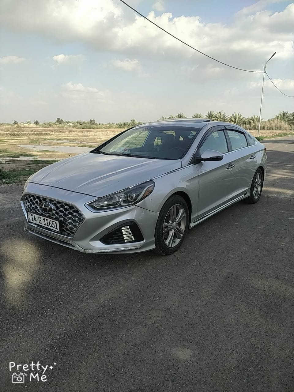 ياالله سلام عليكم سوناتا موديل 2018فول مواصفات sport أمريكي حادث جاملغ وبنيد رقم شمالي سنويه جديده ل2031هزه جديده                         تريد تحويل أو وكاله اني حاضر.    السعر 128وبيه مجال للشراي للاستفسار أتصل ***********.           ***********
