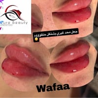 تجميل جراحي • بيور بيوتي • بسمايه السكني