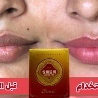 كريم دم التنين الاصلي 💋💋   كريم ماسك دم التنين ♥️♥️ مرطب ومورد مغذي شف...