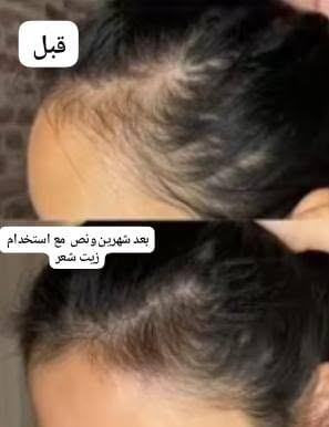 https://whatsapp.com/channel/0029VaBhwLQ8kyyUHd6VwY3I


**إذا كنت صاحب هذا الإعلان وتريد حذفه لأي سبب، رجاءا أرسل رسالة إلى الدعم الفني**