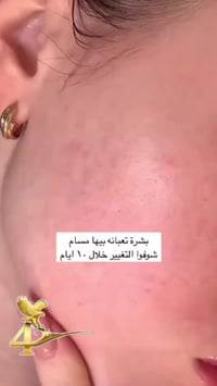 كريم بشرة • ترطيب عميق • تفتيح ونضارة