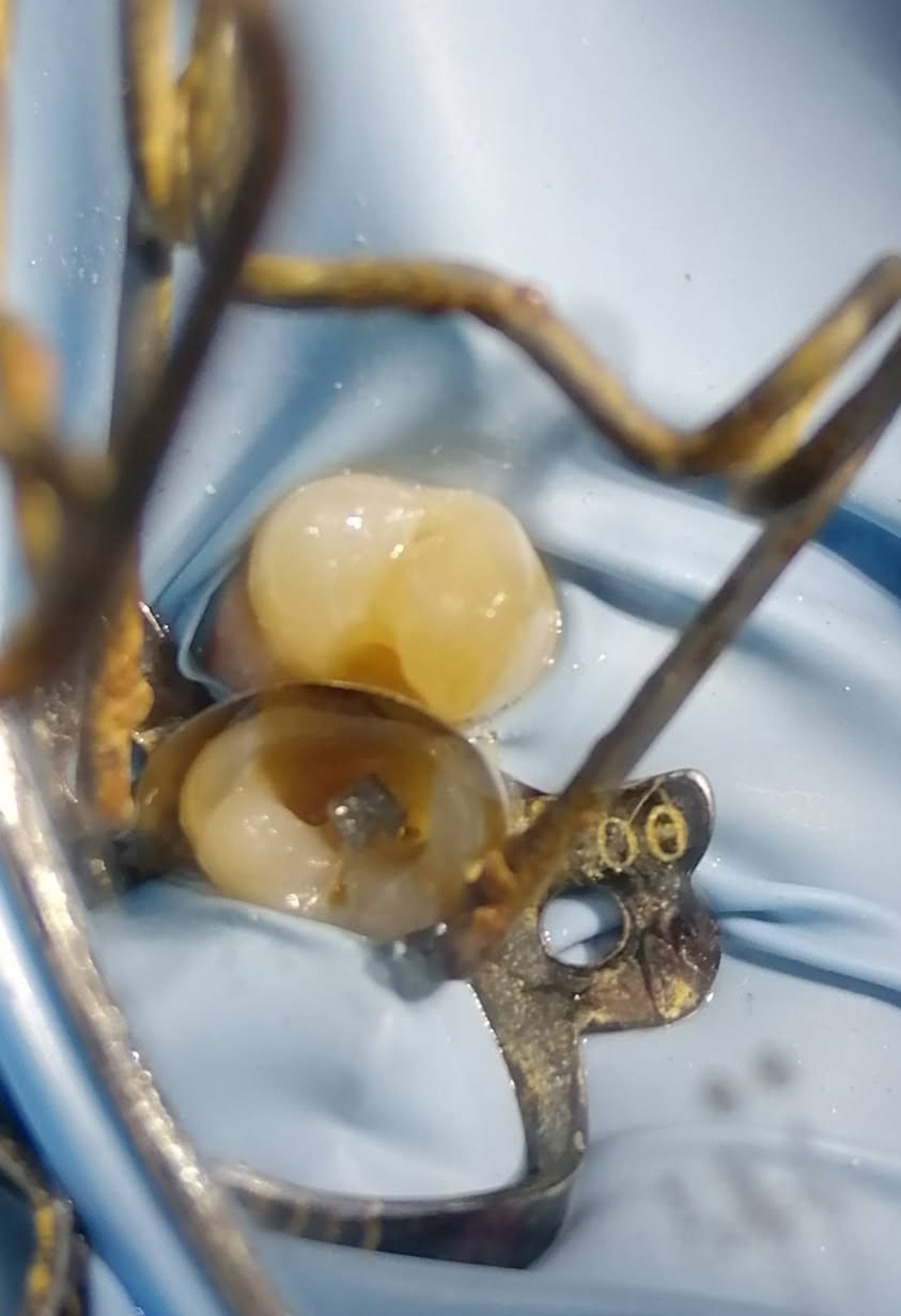 د مهند عبد الجواد الطحان الهاشمي.. ماجستير ودبلوم عالي تعويض الأسنان.. سايدين مستشفى #القيارهالعام.. للحجز والاستفسار التواصل على الرقم ***********# مجاور صيدليه عبدالله المعماري.. طابق ارضى
